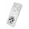 Onegif Xiaomi Redmi 14C Misk Simli Magsafe Kapak - Desen 2