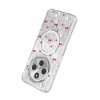 Onegif Xiaomi Redmi 14C Misk Simli Magsafe Kapak - Desen 5