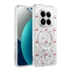 Onegif Xiaomi Redmi Note 15 Pro 5G Misk Simli Magsafe Kapak - Desen 5