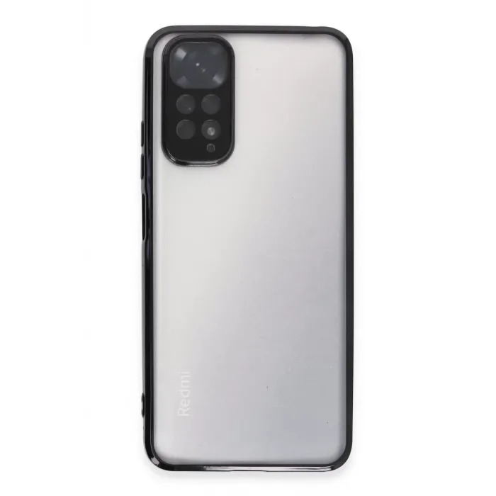 Newface Xiaomi Redmi Note 11 Kılıf Razer Lensli Silikon - Siyah