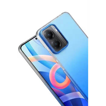 Newface Xiaomi Poco X7 Pro Glossy Kapak - Mavi