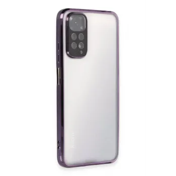 Newface Xiaomi Redmi Note 11 Kılıf Razer Lensli Silikon - Mor