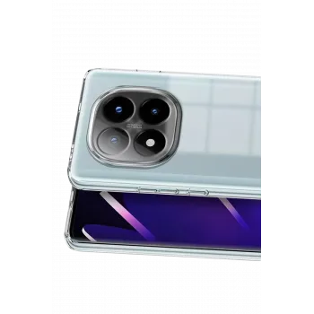Newface Xiaomi Redmi Note 15 Pro Plus 5G Lüx Şeffaf Silikon - Şeffaf