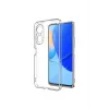 Newface Huawei Nova 9 SE Kılıf Lüx Şeffaf Silikon
