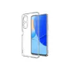 Newface Huawei Nova 9 SE Kılıf Lüx Şeffaf Silikon