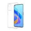 Newface Oppo A96 Kılıf Lüx Şeffaf Silikon