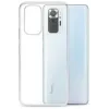 Newface Xiaomi Redmi Note 10 Kılıf Lüx Şeffaf Silikon