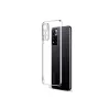 Newface Xiaomi Redmi Note 11 Pro Plus 5G Kılıf Lüx Şeffaf Silikon