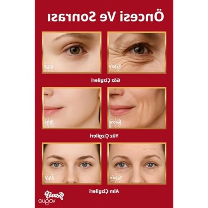 Boyun Sıkılaştırıcı Masaj Aleti - Kırışıklık Giderici