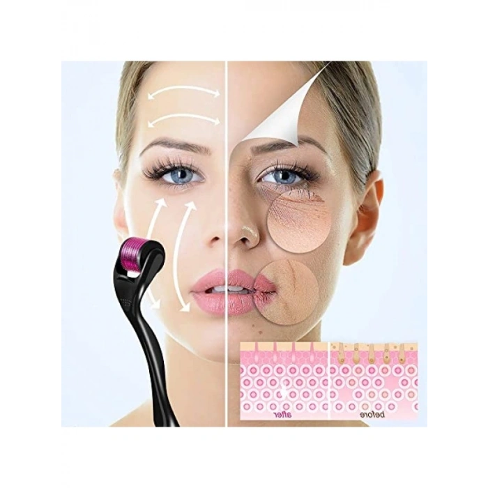 Derma Roller - 1.0mm, 540 Mikro İğne