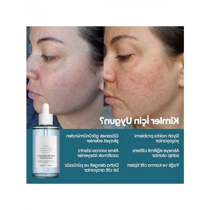Gözenek Sıkılaştırıcı Niacinamide Yüz Serumu, 50 ml