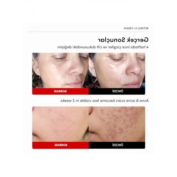 Kırışıklık Karşıtı Yenileyici Retinol Krem