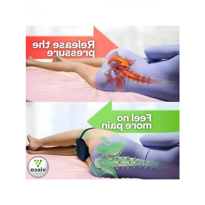 Ortopedik Bacak Arası Yastık - Destekli Visco Yastık
