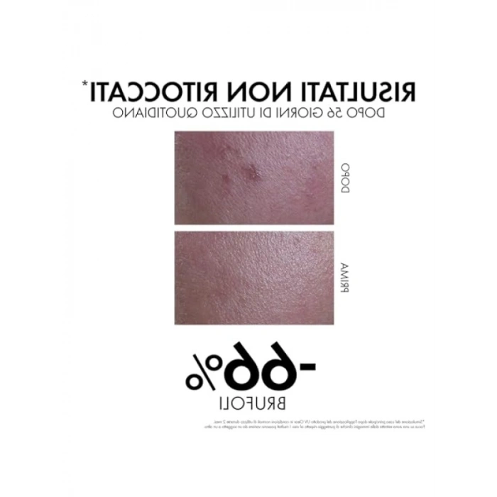 SPF 50 Güneş Koruyucu - Yağlı ve Akneye Eğilimli Ciltler için - 40 ml