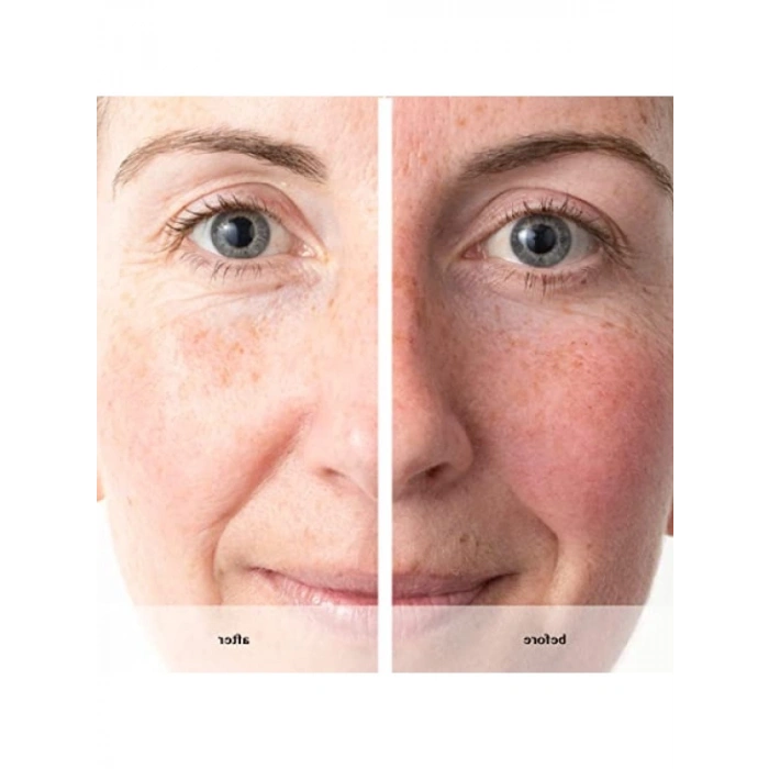 Yenileyici Serum - 30 ml