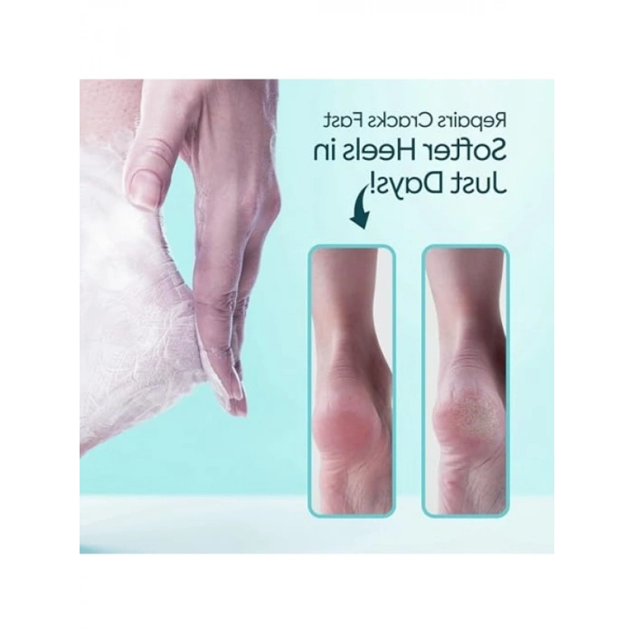 Yoğun Nemlendirici Ayak Kremi, E Vitamini ve Avokado Yağı ile, 100 ml