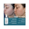 Gözenek Sıkılaştırıcı Niacinamide Yüz Serumu, 50 ml
