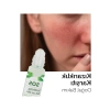 SOS Cilt Serumu - Akne ve Sivilce Karşıtı (30 ml)