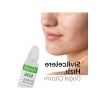 SOS Cilt Serumu - Akne ve Sivilce Karşıtı (30 ml)