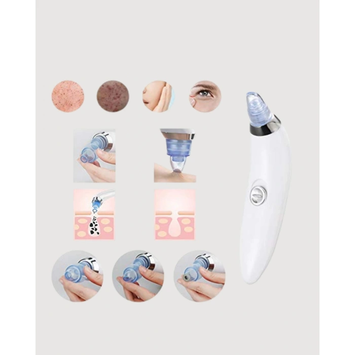 Vakum Teknolojili Siyah Nokta Temizleyici Cihaz – 4 Farklı Başlık ve Derinlemesine Gözenek Temizliği