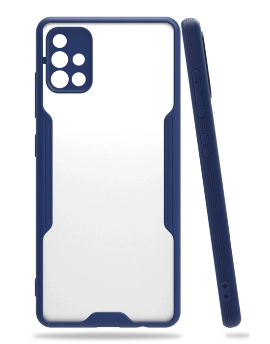 Newface Samsung Galaxy A71 Kılıf Platin Silikon - Lacivert