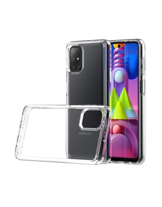Newface Samsung Galaxy M51 Kılıf Lüx Şeffaf Silikon