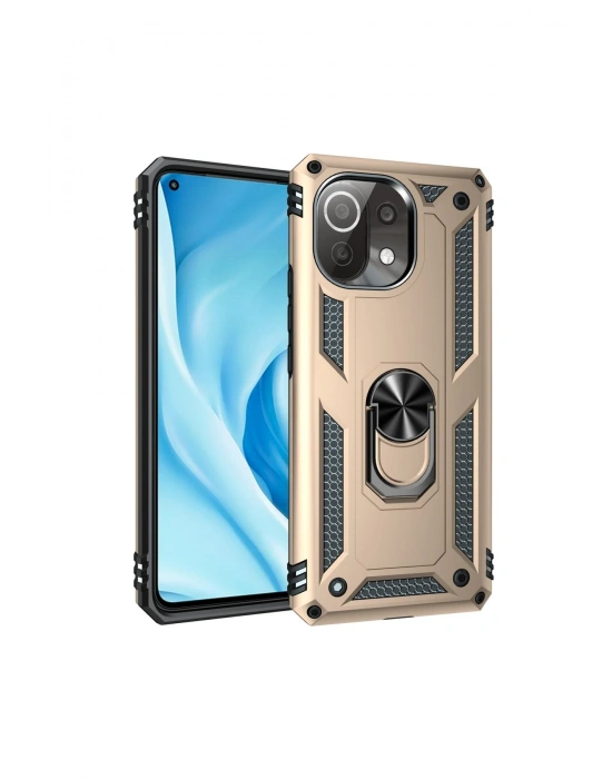 Newface Xiaomi Mİ 11 Lite Kılıf Sofya Yüzüklü Silikon Kapak - Gold