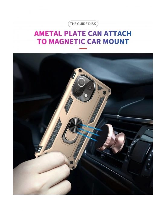 Newface Xiaomi Mİ 11 Lite Kılıf Sofya Yüzüklü Silikon Kapak - Gold