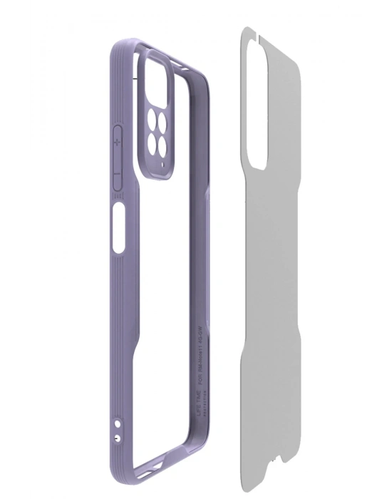 Newface Xiaomi Redmi Note 11 Kılıf Platin Silikon - Siyah