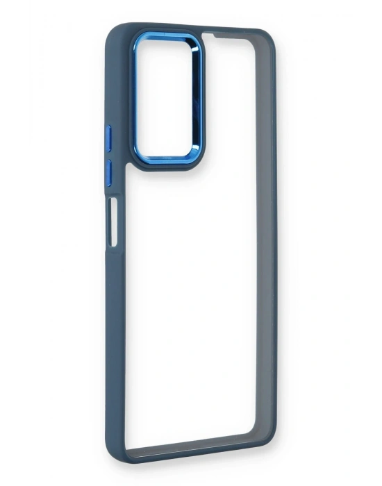 Newface Xiaomi Redmi Note 11 Pro Kılıf Dora Kapak - Mavi