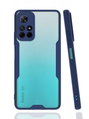 Newface Xiaomi Redmi Note 11T Kılıf Platin Silikon - Lacivert