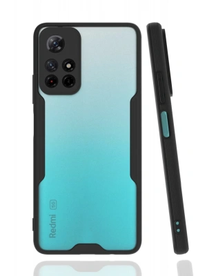 Newface Xiaomi Redmi Note 11T Kılıf Platin Silikon - Siyah