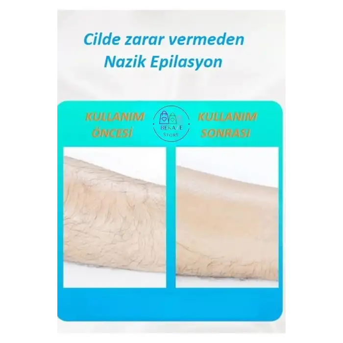 Crystal Eraser Epilasyon Aleti