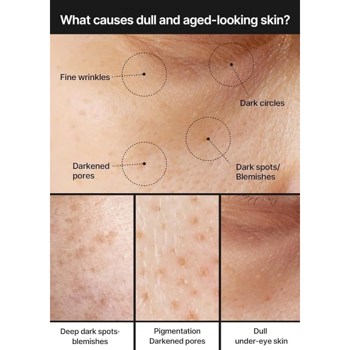 35 ml Leke Karşıtı Aydınlatıcı Krem, Cilt Bakımı