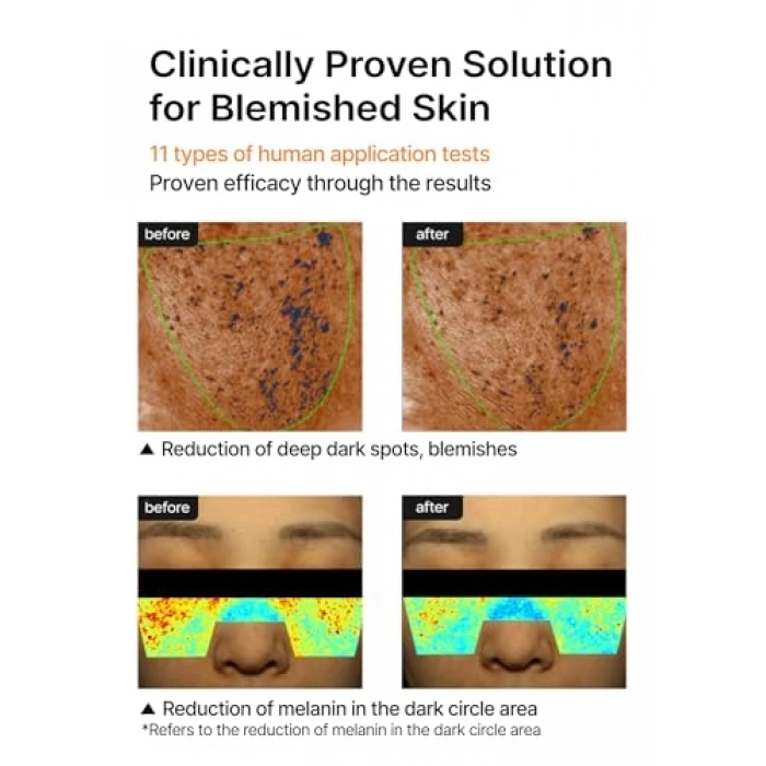 35 ml Leke Karşıtı Aydınlatıcı Krem, Cilt Bakımı