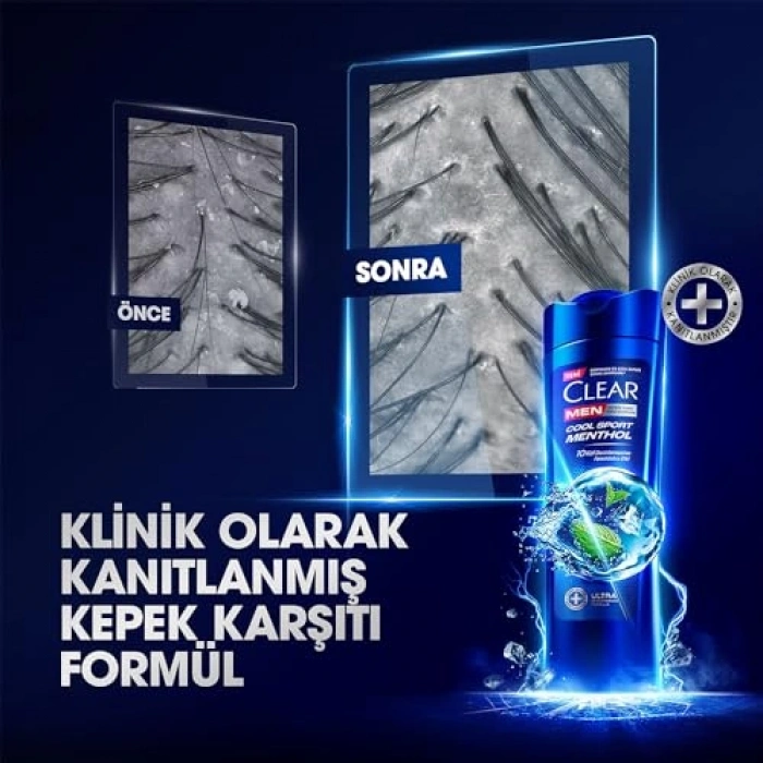 350 ml Ferahlatıcı Kepeğe Karşı Şampuan