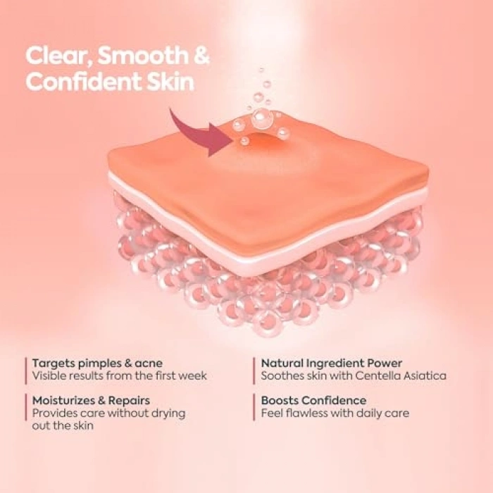 40 ml Sivilce ve Akne Karşıtı Leke Kremi