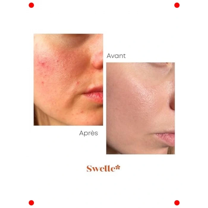 Ardıç Katranı & Sandal Ağacı Özlü Cilt Sabunu