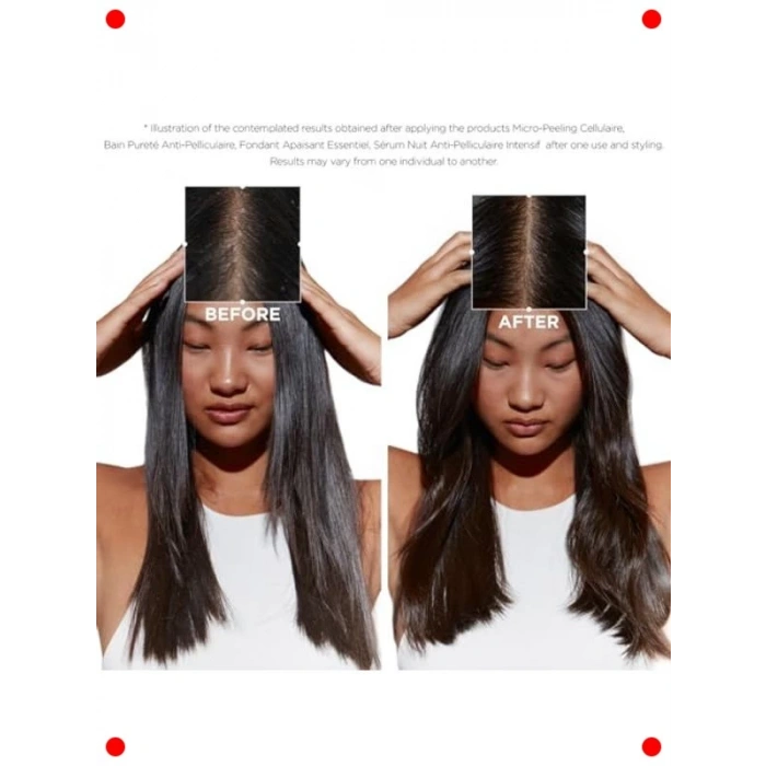 Arındırıcı Kepek Karşıtı Şampuan 250 ml