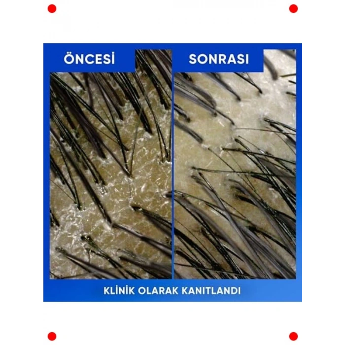 Arındırıcı ve Parlak Kepek Karşıtı Şampuan 800ml