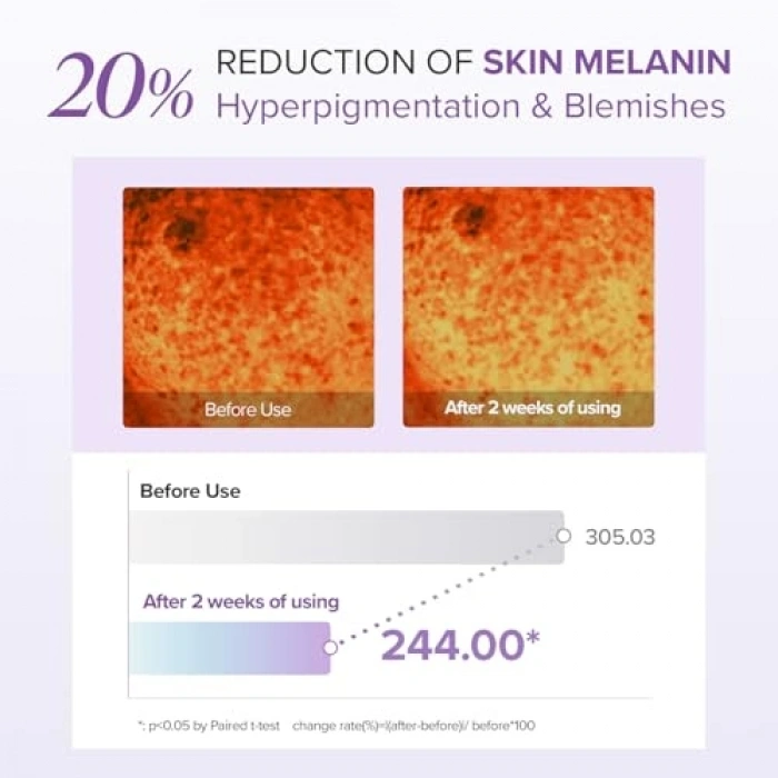 Aydınlatıcı Göz Çevresi Kremi 30 gr - Tranexamik Asit İçerikli