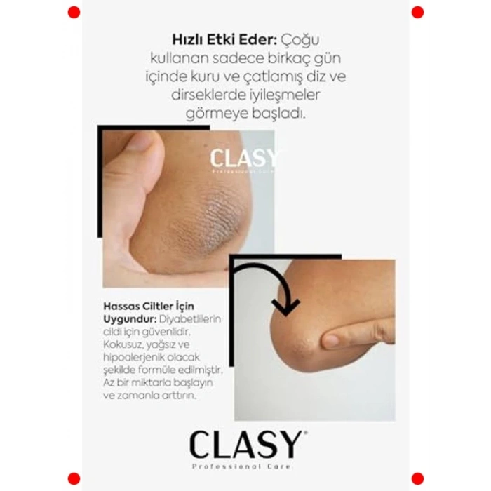 Çatlak Onarıcı Yoğun Nemlendirici Krem - Diz & Dirsek