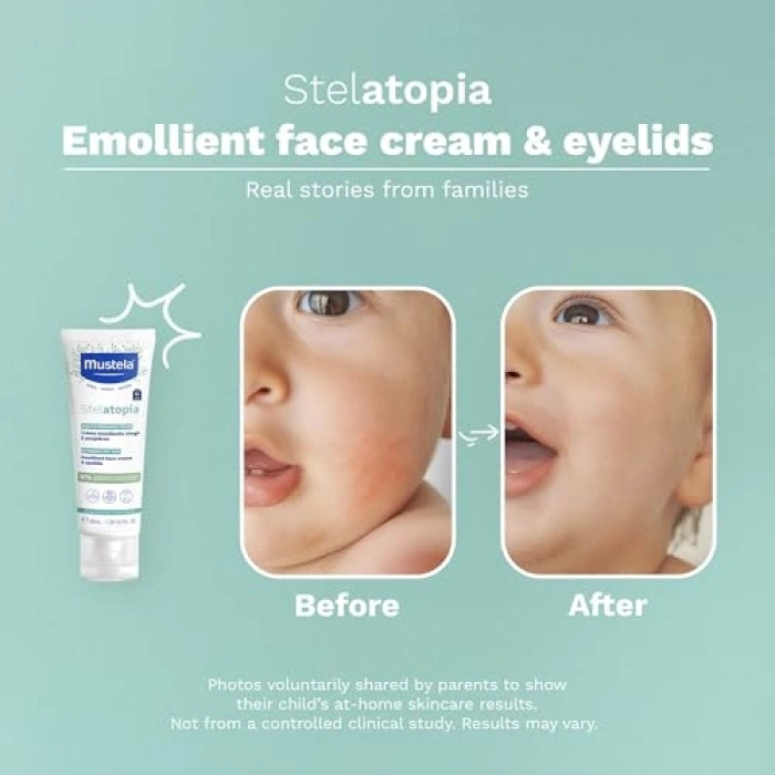 Emollient Yüz Kremi, 40 ml