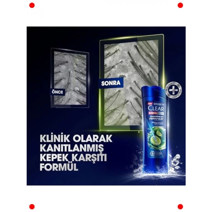 Erkeklere Özel Kepek Karşıtı Maksimum Ferahlık Şampuanı