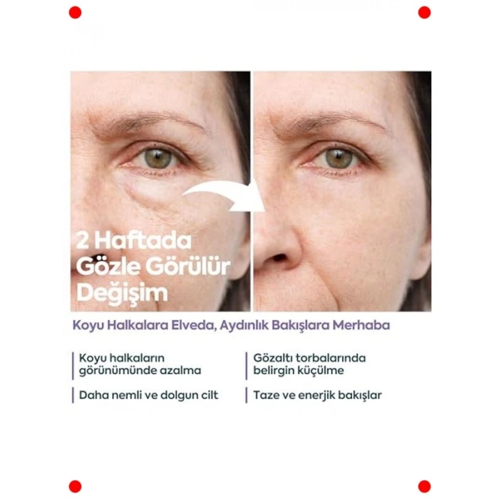 Göz Altı Kremi - Kafein & Hyaluronik Asit - 40 ml