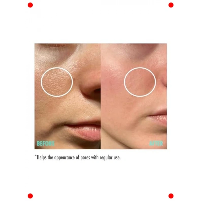 Gözenek Sıkılaştırıcı Cilt Serumu 30 ml