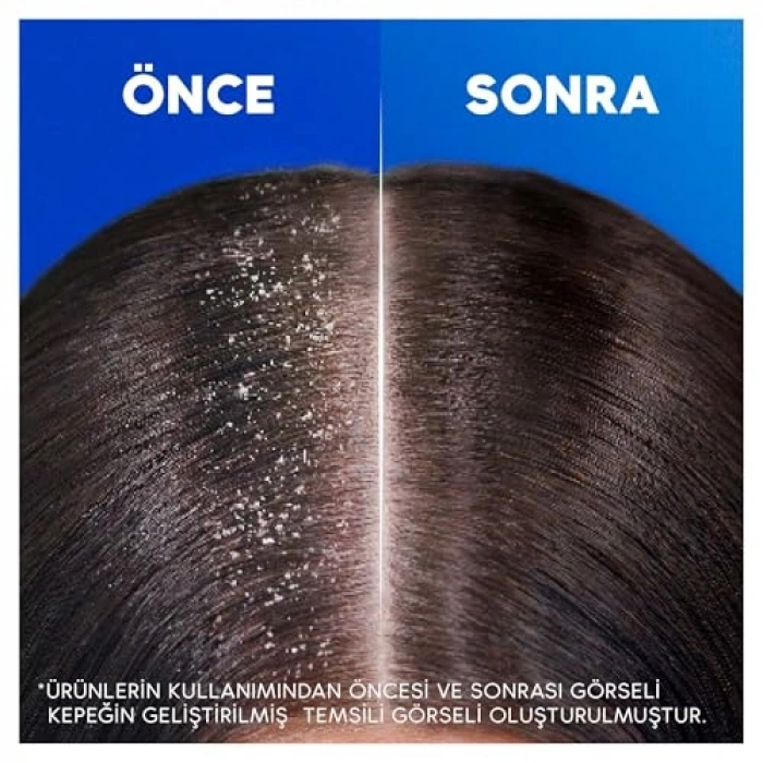 Head & Shoulders Aleovera Özlü Şampuan 330ml
