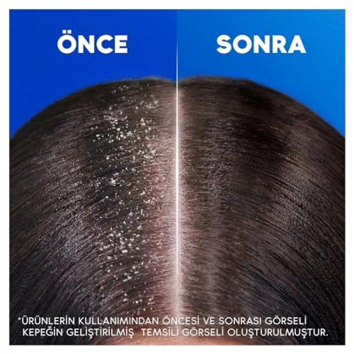 Head & Shoulders Besleyici Bakım Şampuan 330 ml