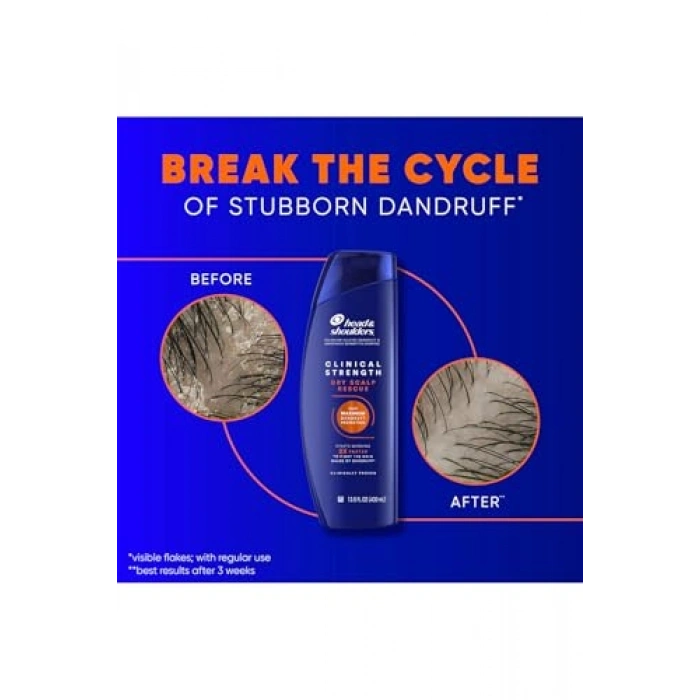 Head & Shoulders Clinical Strength Şampuan 400 ml