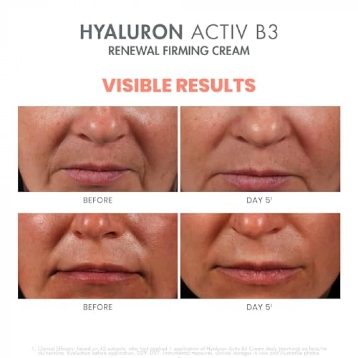 Hyaluron Activ B3 Krem 50 ml, Cilt Bakımı